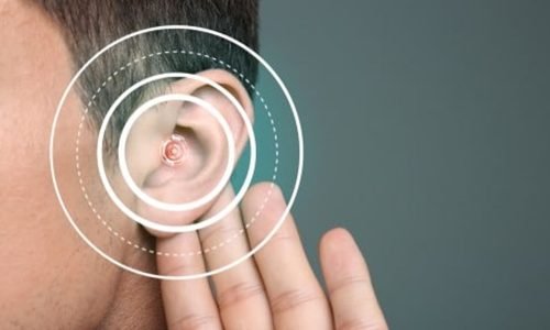 Addressing Hearing Loss